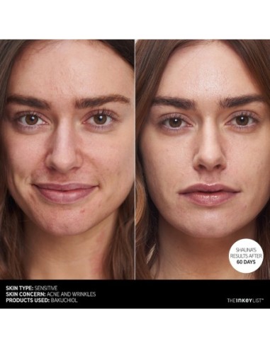 Bakuchiol Moisturizer