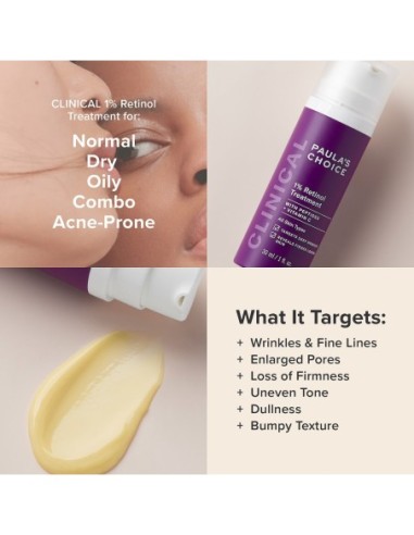 1% Retinol Treatment