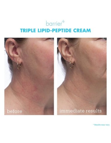 Barrier+ Triple Lipid-Peptide Cream