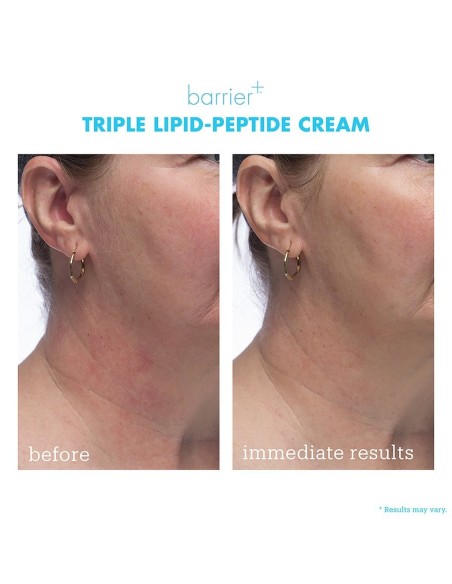 Barrier+ Triple Lipid-Peptide Cream