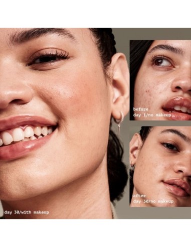 *PRONTO* Acne Fighting Putty Primer