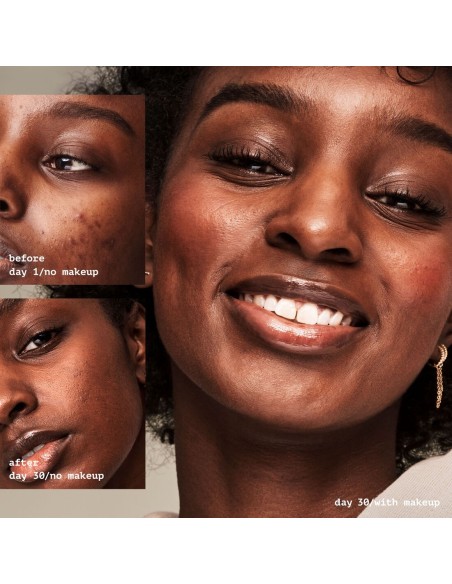 *PRONTO* Acne Fighting Putty Primer