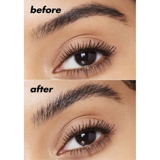Brow Lift 2