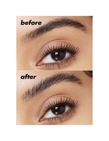 Brow Lift