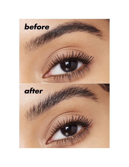 Brow Lift