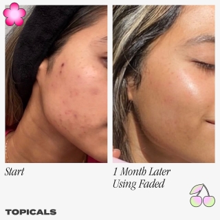 Faded Serum for Dark Spots & Discoloration 2