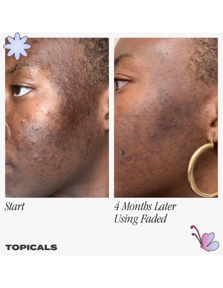 Faded Serum for Dark Spots & Discoloration