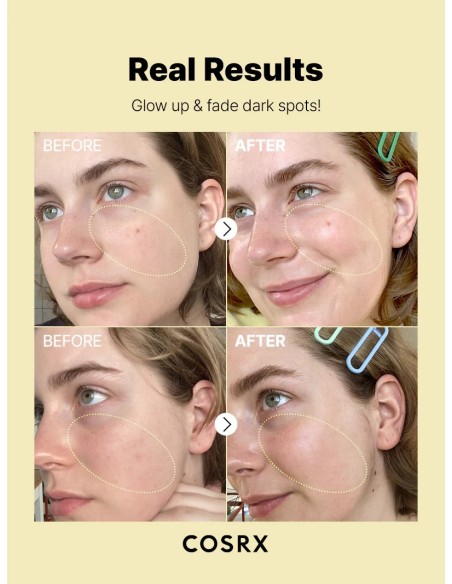 The Vitamin C 23 Serum