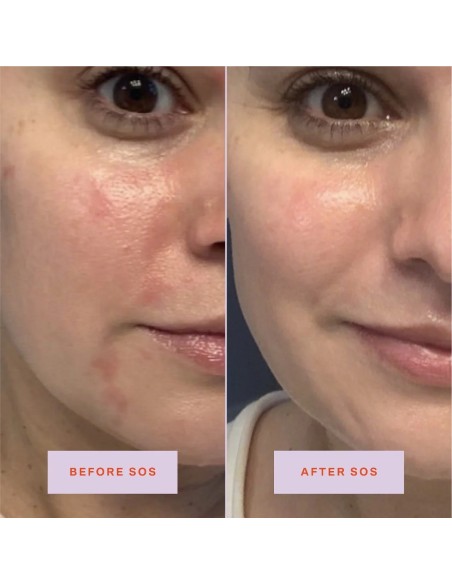 *SOBRE PEDIDO* SOS Daily Rescue Facial Spray