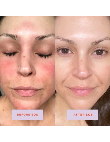 *SOBRE PEDIDO* SOS Daily Rescue Facial Spray