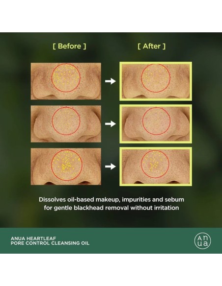 Heartleaf Pore Control Cleansing Oil