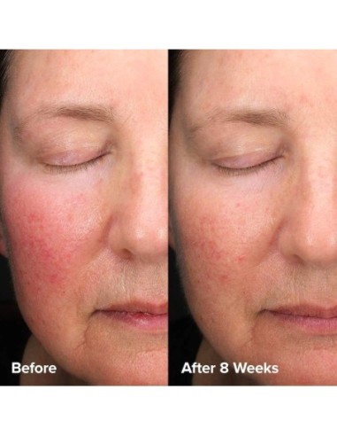 *SOBRE PEDIDO* Skin Perfecting 6% Mandelic Acid + 2% Lactic Acid Liquid Exfoliant