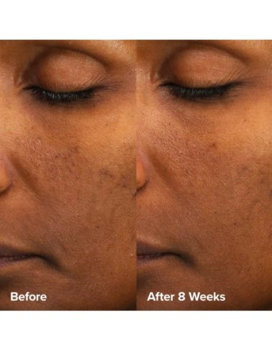 *SOBRE PEDIDO* Skin Perfecting 6% Mandelic Acid + 2% Lactic Acid Liquid Exfoliant