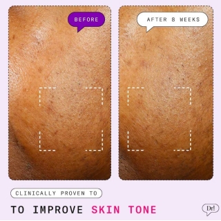 *SOBRE PEDIDO* Major Fade Active Seal Dark Spot Vitamin C Gel Moisturizer 2