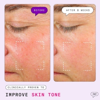 *SOBRE PEDIDO* Major Fade Hyper Serum Dark Spot Treatment 2