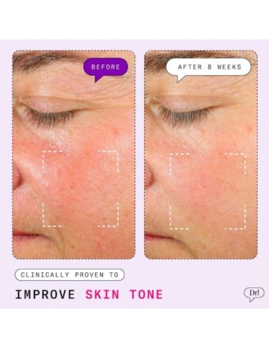 *SOBRE PEDIDO* Major Fade Hyper Serum Dark Spot Treatment