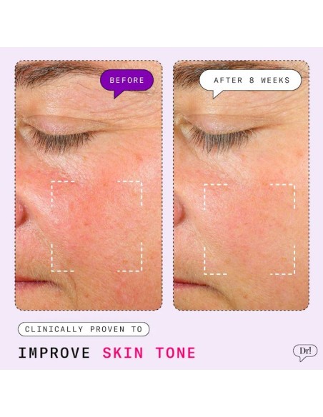 *SOBRE PEDIDO* Major Fade Hyper Serum Dark Spot Treatment