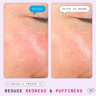 *SOBRE PEDIDO* The Depuffer Redness Reducing + Depuffing Roll-On Serum 2