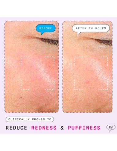 *SOBRE PEDIDO* The Depuffer Redness Reducing + Depuffing Roll-On Serum