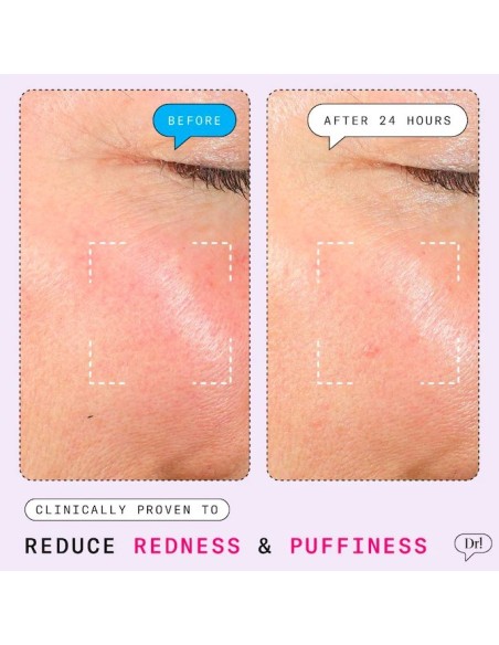 *SOBRE PEDIDO* The Depuffer Redness Reducing + Depuffing Roll-On Serum