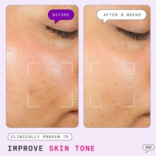 *SOBRE PEDIDO* Major Fade Dark Spot AHA Face Mask 2