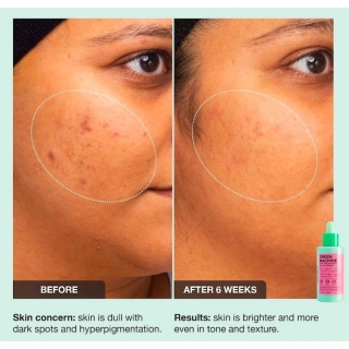 *SOBRE PEDIDO* Green Machine Vitamin C Dark Spot & Hyperpigmentation Serum 2