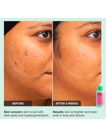 *SOBRE PEDIDO* Green Machine Vitamin C Dark Spot & Hyperpigmentation Serum