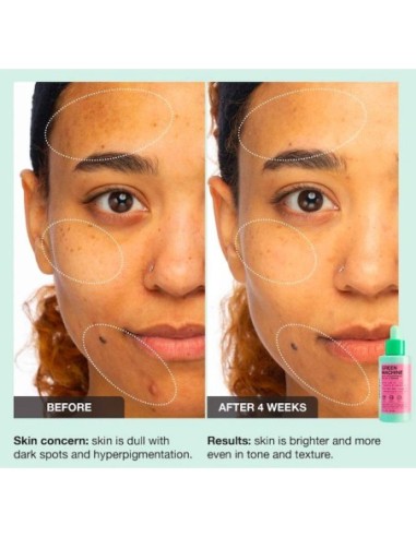 *SOBRE PEDIDO* Green Machine Vitamin C Dark Spot & Hyperpigmentation Serum