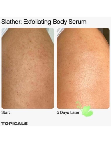*SOBRE PEDIDO* Slather Exfoliating Body Serum with Retinol and AHAs