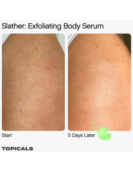 *SOBRE PEDIDO* Slather Exfoliating Body Serum with Retinol and AHAs